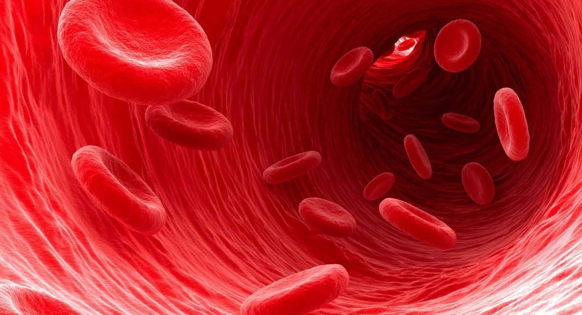 Kondisi Anemia Karena Rendahnya Kadar Hemoglobin