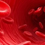 Kondisi Anemia Karena Rendahnya Kadar Hemoglobin