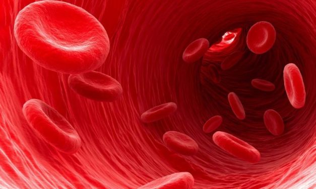 Kondisi Anemia Karena Rendahnya Kadar Hemoglobin