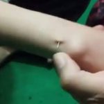 Praktik Tradisional Susuk Biasanya Pada Seorang Perempuan