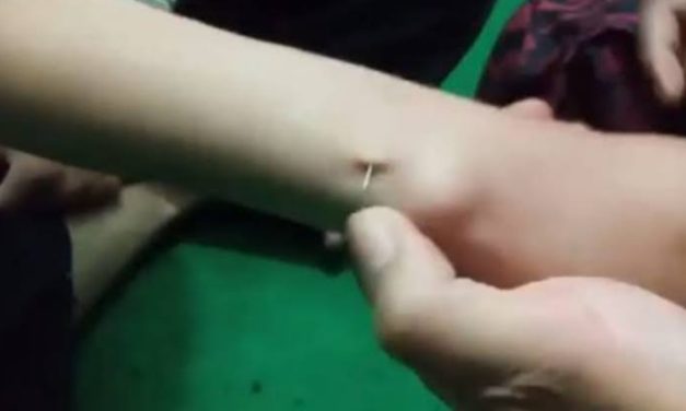 Praktik Tradisional Susuk Biasanya Pada Seorang Perempuan