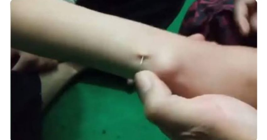Praktik Tradisional Susuk Biasanya Pada Seorang Perempuan